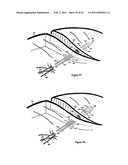 Elastic tissue closure with elastic staple diagram and image