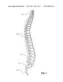 ASSEMBLIES FOR PROVISION OF THERAPY TO MOTION SEGMENTS diagram and image