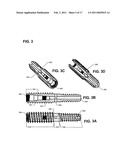 ASSEMBLIES FOR PROVISION OF THERAPY TO MOTION SEGMENTS diagram and image