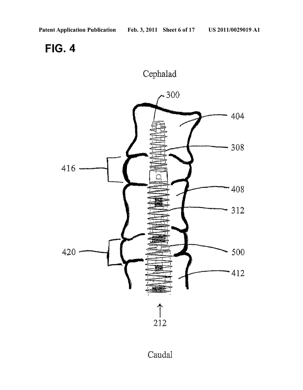 ASSEMBLIES FOR PROVISION OF THERAPY TO MOTION SEGMENTS - diagram, schematic, and image 07