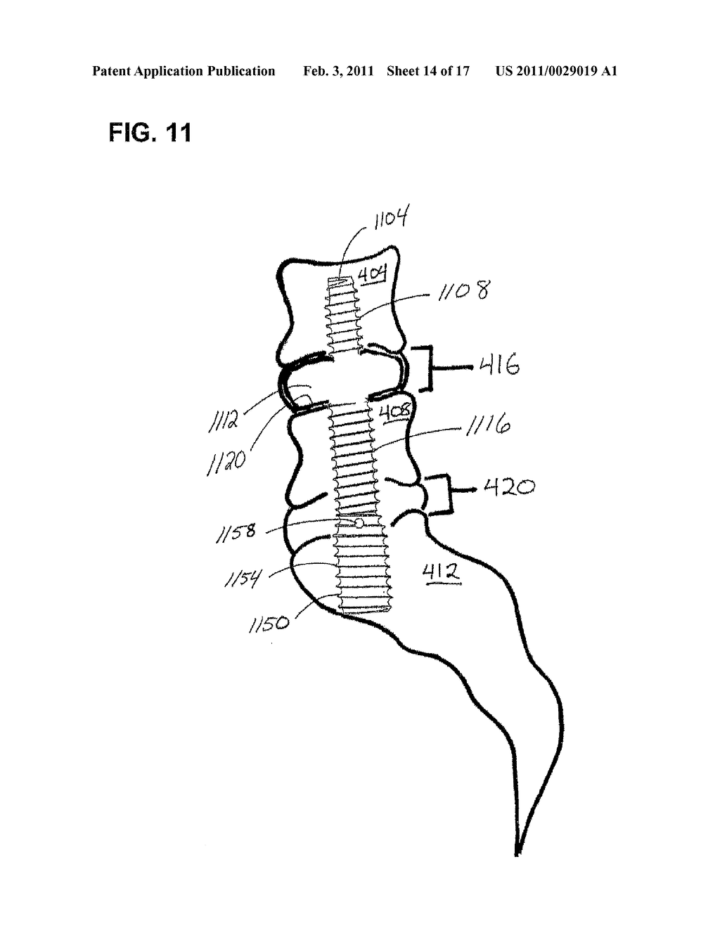 ASSEMBLIES FOR PROVISION OF THERAPY TO MOTION SEGMENTS - diagram, schematic, and image 15