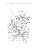 SLIDE-TYPE ANTI-BACKOUT DEVICE FOR PROSTHESIS diagram and image