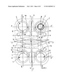 SLIDE-TYPE ANTI-BACKOUT DEVICE FOR PROSTHESIS diagram and image