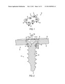 FIXATION PLATE SCREW RETENTION diagram and image