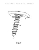 FIXATION PLATE SCREW RETENTION diagram and image