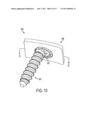 FIXATION PLATE SCREW RETENTION diagram and image