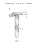 FIXATION PLATE SCREW RETENTION diagram and image