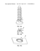 FIXATION PLATE SCREW RETENTION diagram and image