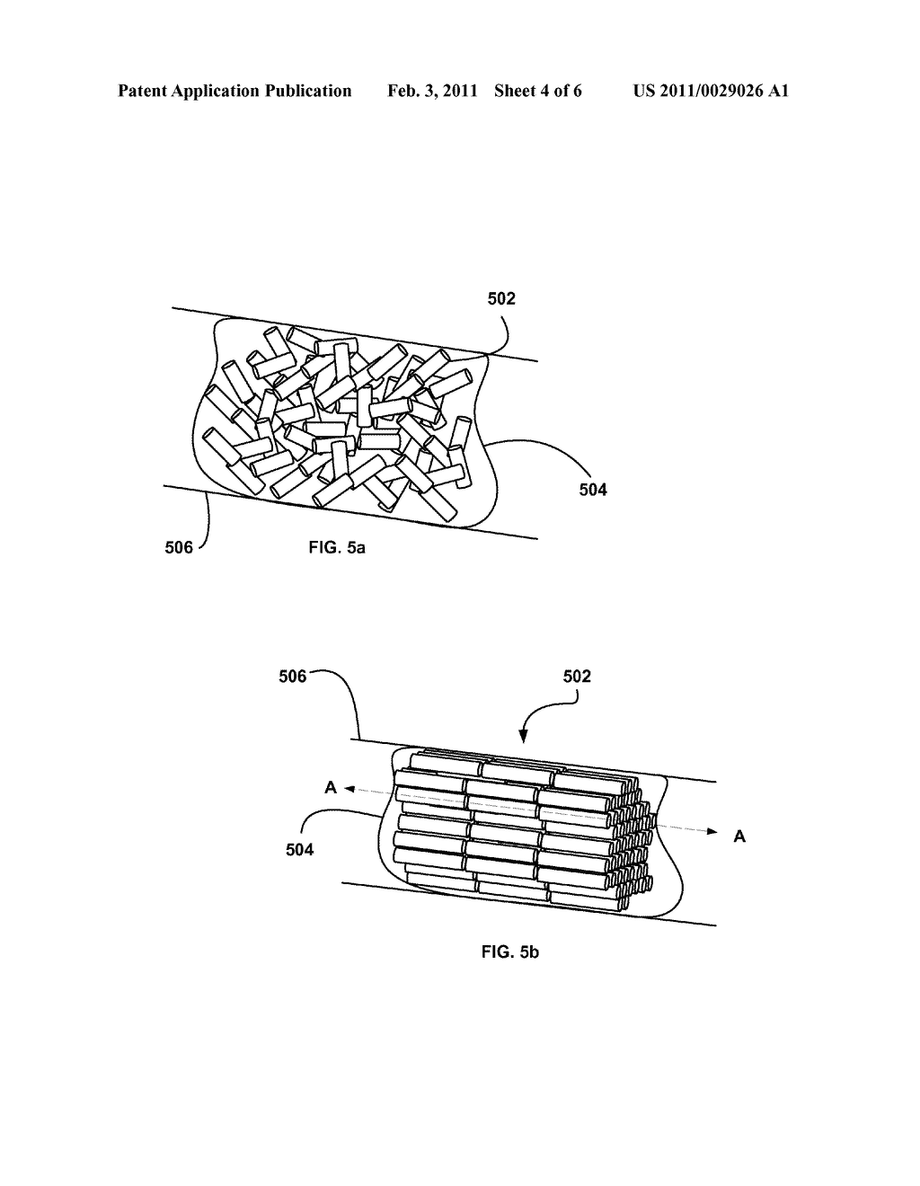 Micro-Structure Particles For Load Bearing Bone Growth - diagram, schematic, and image 05