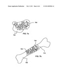 Micro-Structure Particles For Load Bearing Bone Growth diagram and image