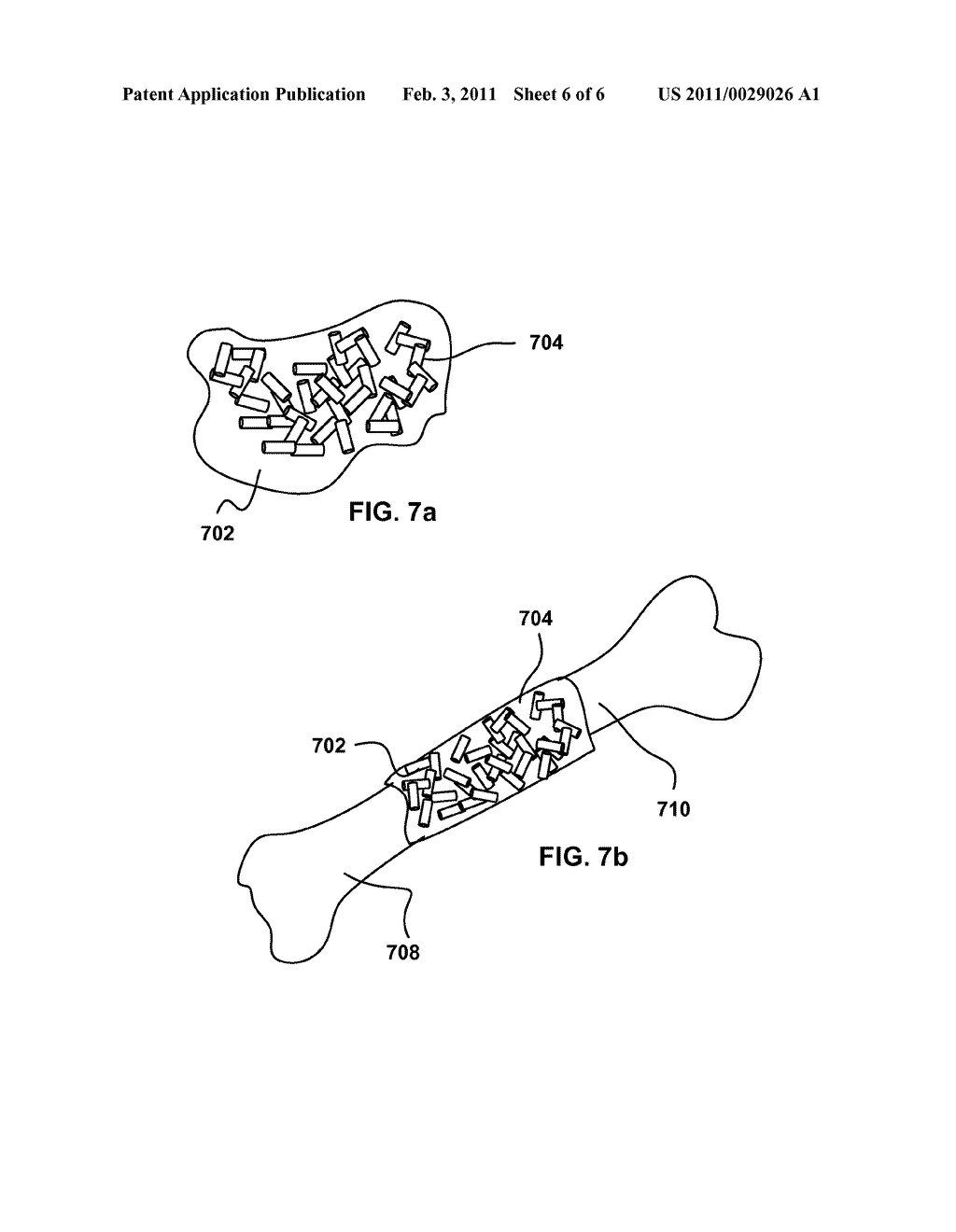 Micro-Structure Particles For Load Bearing Bone Growth - diagram, schematic, and image 07