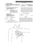 Cardioverter-Defibrillator Having a Focused Shocking Area and Orientation Thereof diagram and image