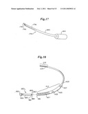 Cardioverter-Defibrillator Having a Focused Shocking Area and Orientation Thereof diagram and image