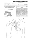 Co-Fired Electrical Feedthroughs for Implantable Medical Devices Having a Shielded RF Conductive Path and Impedance Matching diagram and image