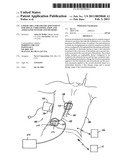 LINKED AREA PARAMETER ADJUSTMENT FOR SPINAL CORD STIMULATION AND ASSOCIATED SYSTEMS AND METHODS diagram and image