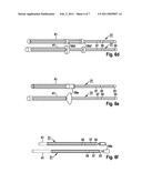 IMPLANTABLE CATHETER LEAD OR ELECTRODE LEAD diagram and image