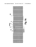 FLEXIBLE STENT diagram and image