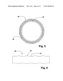 FLEXIBLE STENT diagram and image