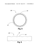 FLEXIBLE STENT diagram and image