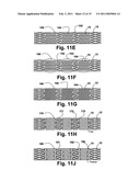 FLEXIBLE STENT diagram and image