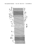 FLEXIBLE STENT diagram and image