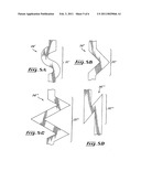 Stent valve and method of using same diagram and image