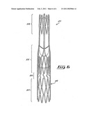 Stent valve and method of using same diagram and image
