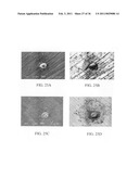 ELECTROCHEMICAL COUPLING OF METALLIC BIOMATERIAL IMPLANTS FOR BIOLOGICAL EFFECT diagram and image