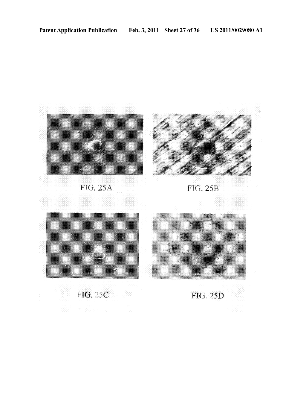 ELECTROCHEMICAL COUPLING OF METALLIC BIOMATERIAL IMPLANTS FOR BIOLOGICAL EFFECT - diagram, schematic, and image 28