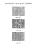 ELECTROCHEMICAL COUPLING OF METALLIC BIOMATERIAL IMPLANTS FOR BIOLOGICAL EFFECT diagram and image