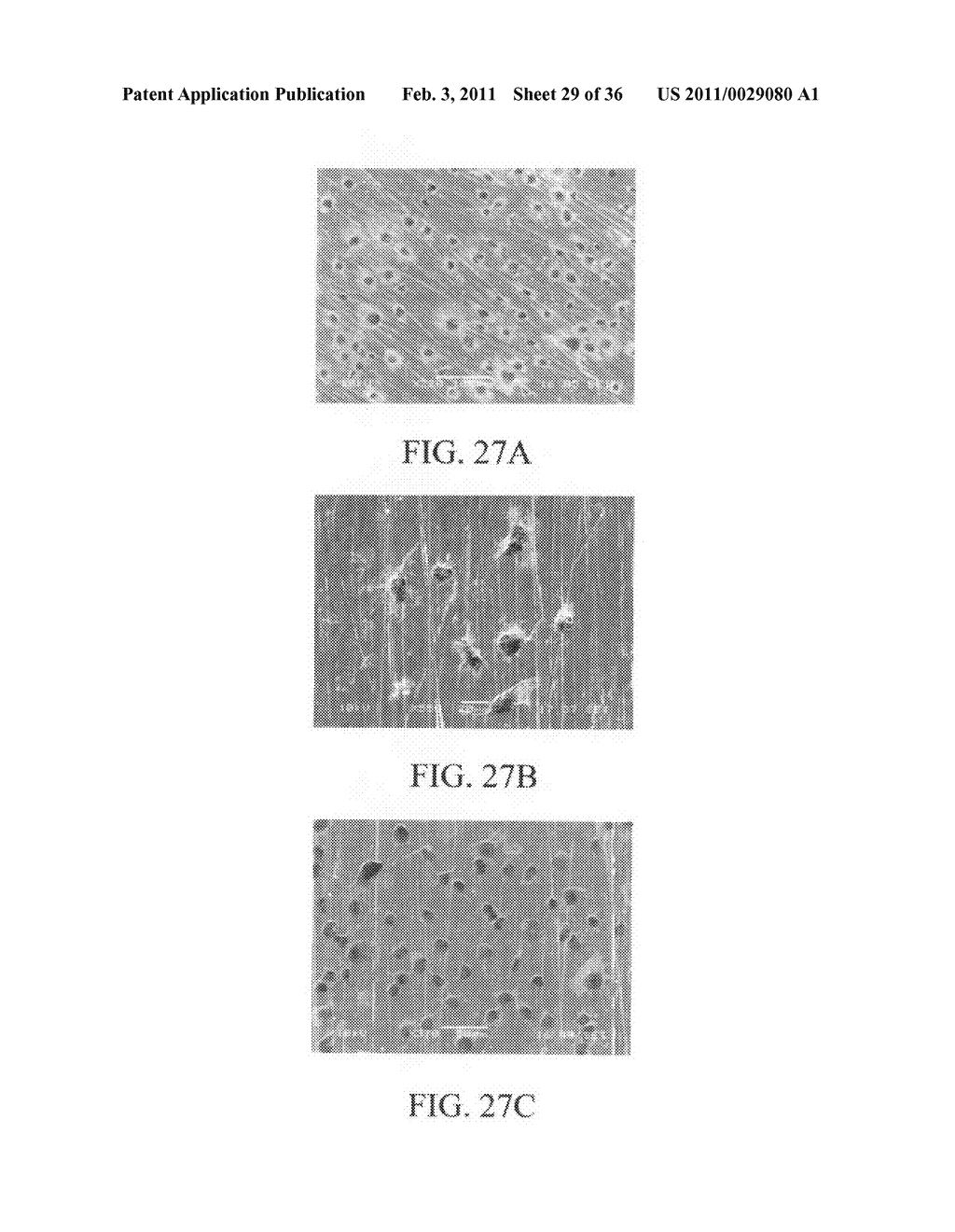 ELECTROCHEMICAL COUPLING OF METALLIC BIOMATERIAL IMPLANTS FOR BIOLOGICAL EFFECT - diagram, schematic, and image 30