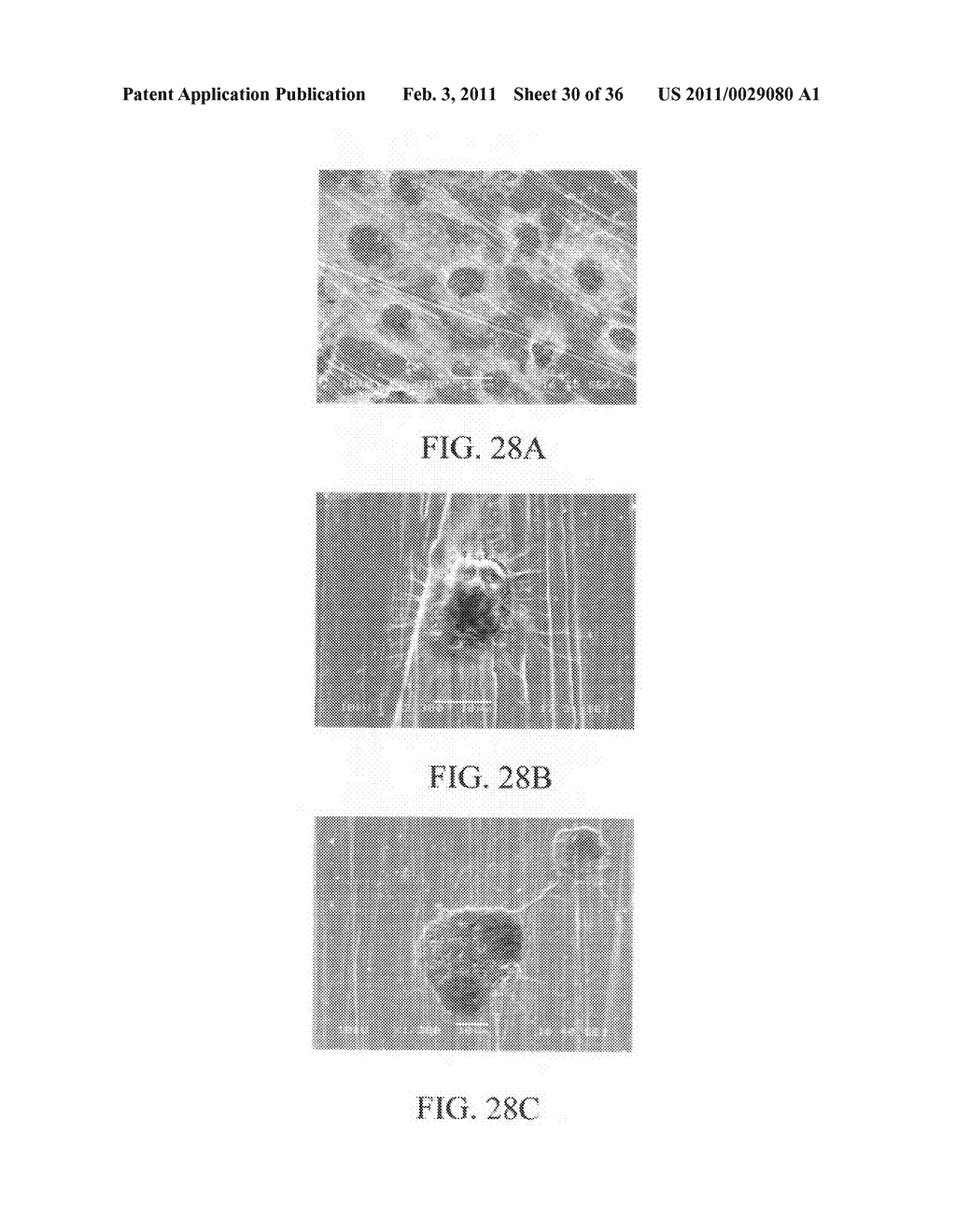 ELECTROCHEMICAL COUPLING OF METALLIC BIOMATERIAL IMPLANTS FOR BIOLOGICAL EFFECT - diagram, schematic, and image 31