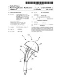 Shoulder Prosthesis diagram and image