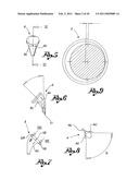 Shoulder Prosthesis diagram and image