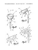 Shoulder Prosthesis diagram and image