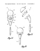 Shoulder Prosthesis diagram and image