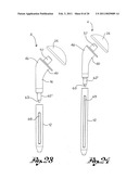 Shoulder Prosthesis diagram and image