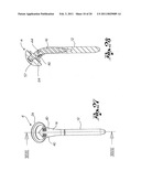 Shoulder Prosthesis diagram and image