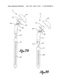 Shoulder Prosthesis diagram and image