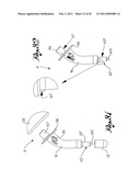 Shoulder Prosthesis diagram and image