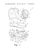 PROSTHESIS WITH MODULAR EXTENSIONS diagram and image