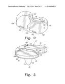 PROSTHESIS WITH MODULAR EXTENSIONS diagram and image