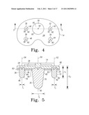 PROSTHESIS WITH MODULAR EXTENSIONS diagram and image