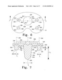 PROSTHESIS WITH MODULAR EXTENSIONS diagram and image