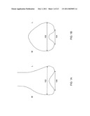 Patient-adapted and improved articular implants, designs and related guide tools diagram and image