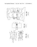 Patient-adapted and improved articular implants, designs and related guide tools diagram and image