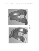 Patient-adapted and improved articular implants, designs and related guide tools diagram and image