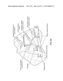 Patient-adapted and improved articular implants, designs and related guide tools diagram and image