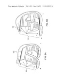 Patient-adapted and improved articular implants, designs and related guide tools diagram and image