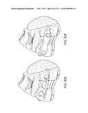 Patient-adapted and improved articular implants, designs and related guide tools diagram and image